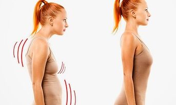 Le ragioni dello sviluppo dell'osteocondosi cervicale