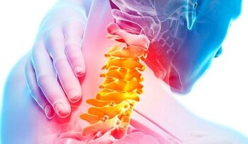 Segni di osteocondosi della colonna cervicale