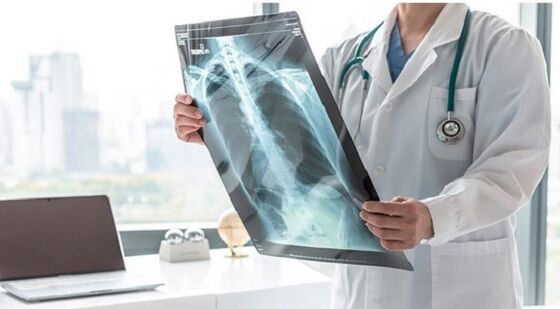 Diagnostica a raggi X per dolore sotto la scapola sinistra