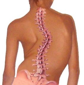 La curvatura della colonna vertebrale porta all'osteocondrosi