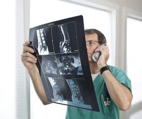 Mielografia per la diagnosi dell'osteocondrosi e delle ernie intervertebrali